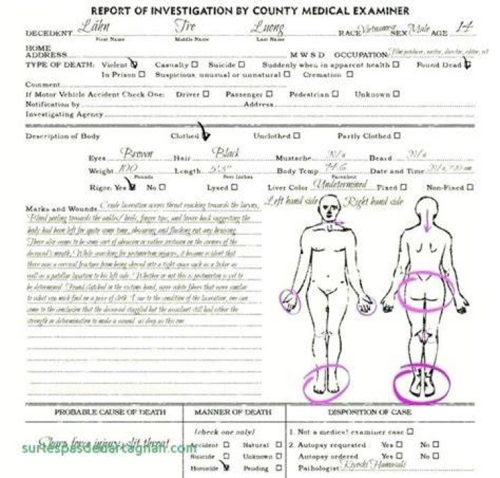 
Gigi Bryant’s autopsy sketch: What we know so far 